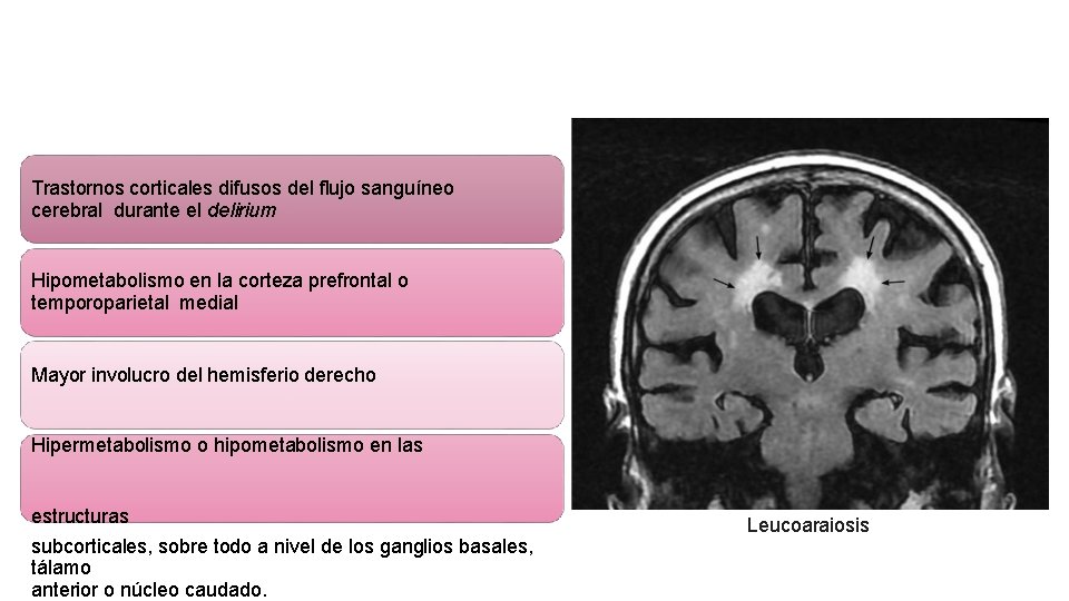 Trastornos corticales difusos del flujo sanguíneo cerebral durante el delirium Hipometabolismo en la corteza