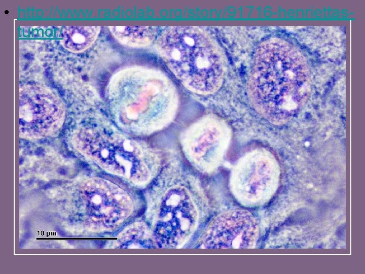  • http: //www. radiolab. org/story/91716 -henriettastumor/ 