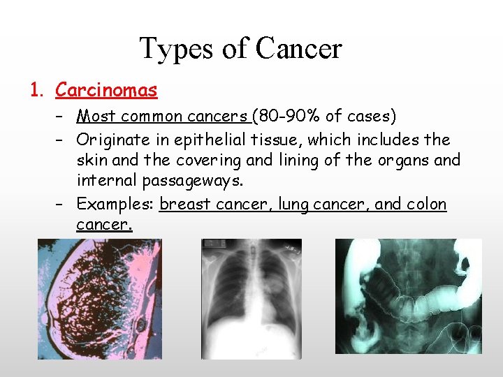 Types of Cancer 1. Carcinomas – Most common cancers (80 -90% of cases) –