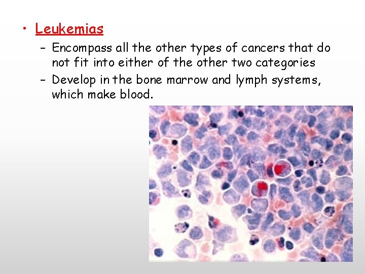  • Leukemias – Encompass all the other types of cancers that do not