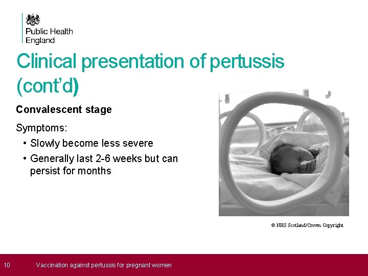 Clinical presentation of pertussis (cont’d) Convalescent stage Symptoms: • Slowly become less severe •