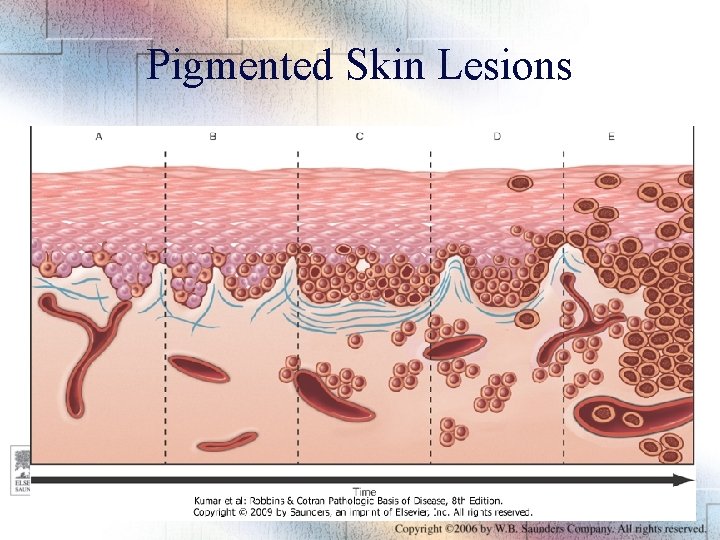 Pigmented Skin Lesions Figure 18 -09 