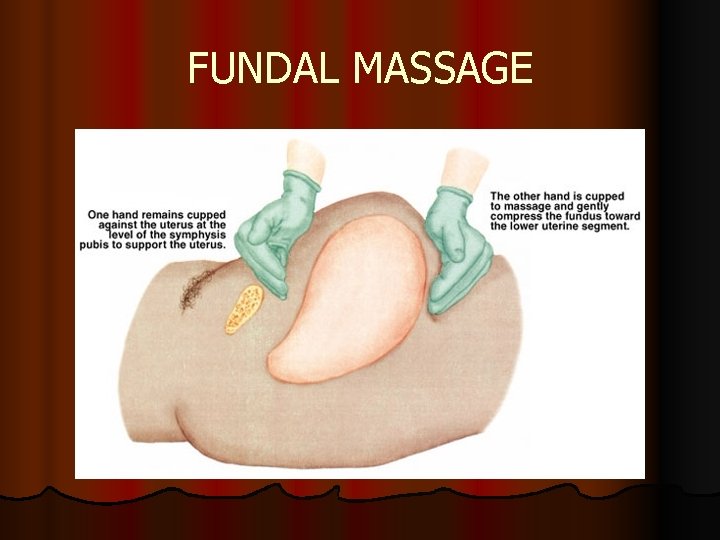 FUNDAL MASSAGE FUNDAL MASSAGE