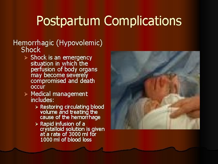 Postpartum Complications Hemorrhagic (Hypovolemic) Shock is an emergency situation in which the perfusion of