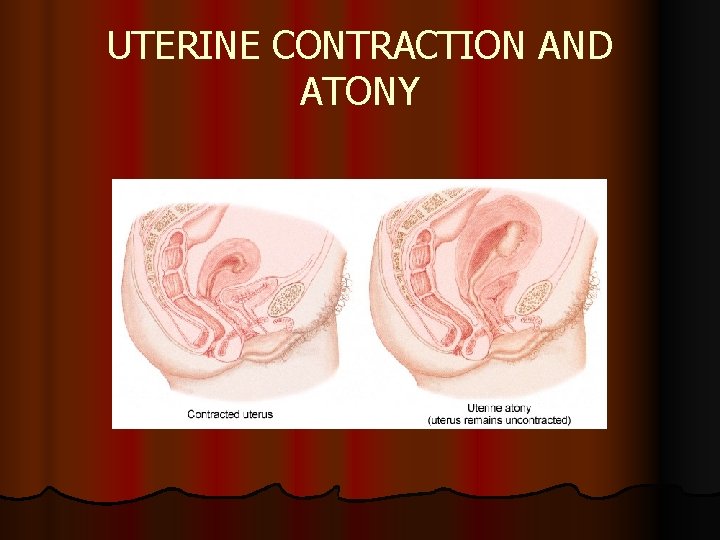 UTERINE CONTRACTION AND ATONY UTERINE CONTRACTION AND ATONY