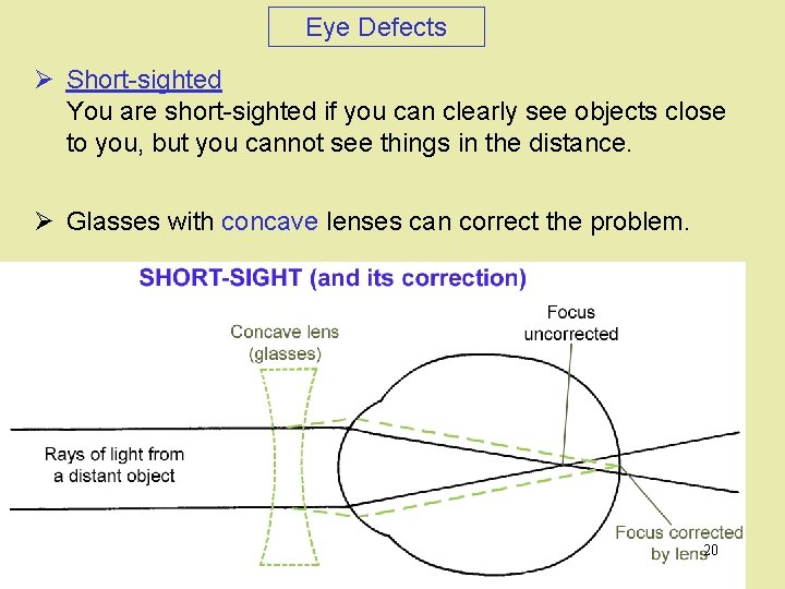 Eye Defects Ø Short-sighted You are short-sighted if you can clearly see objects close