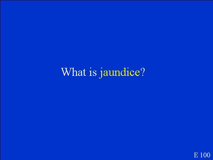 What is jaundice? E 100 