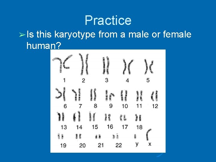 Practice ➢ Is this karyotype from a male or female human? 