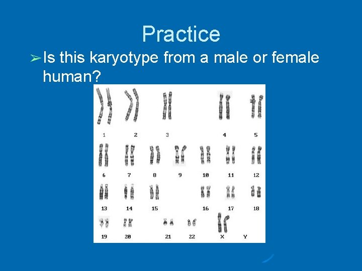 Practice ➢ Is this karyotype from a male or female human? 