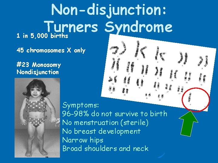 Non-disjunction: Turners Syndrome 1 in 5, 000 births 45 chromosomes X only #23 Monosomy