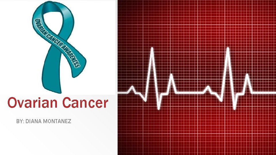 Ovarian Cancer BY: DIANA MONTANEZ 