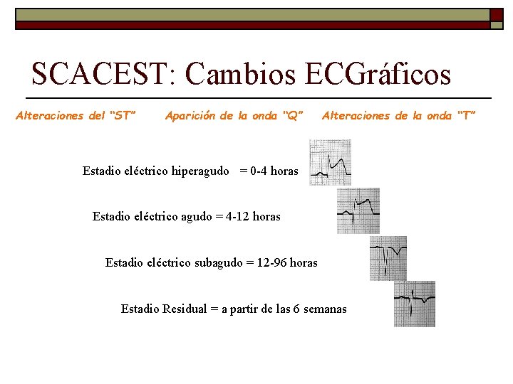 SCACEST: Cambios ECGráficos Alteraciones del “ST” Aparición de la onda “Q” Alteraciones de la