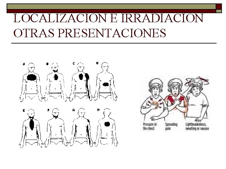 LOCALIZACION E IRRADIACION OTRAS PRESENTACIONES 