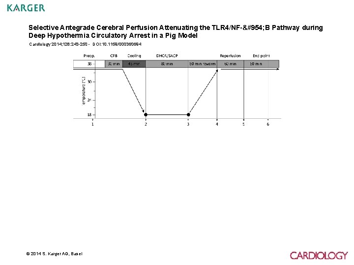 Selective Antegrade Cerebral Perfusion Attenuating the TLR 4/NF-κ B Pathway during Deep Hypothermia Circulatory