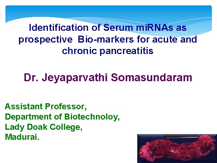 Identification of Serum mi. RNAs as prospective Bio-markers for acute and chronic pancreatitis Dr.