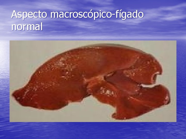 Aspecto macroscópico-fígado normal 