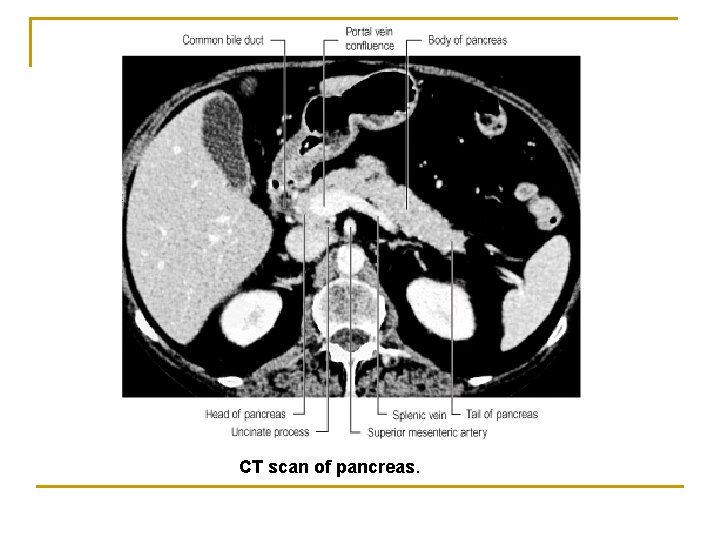 CT scan of pancreas. 