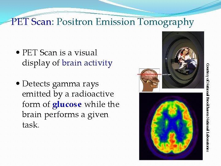 The Brain Made up of neurons and glial