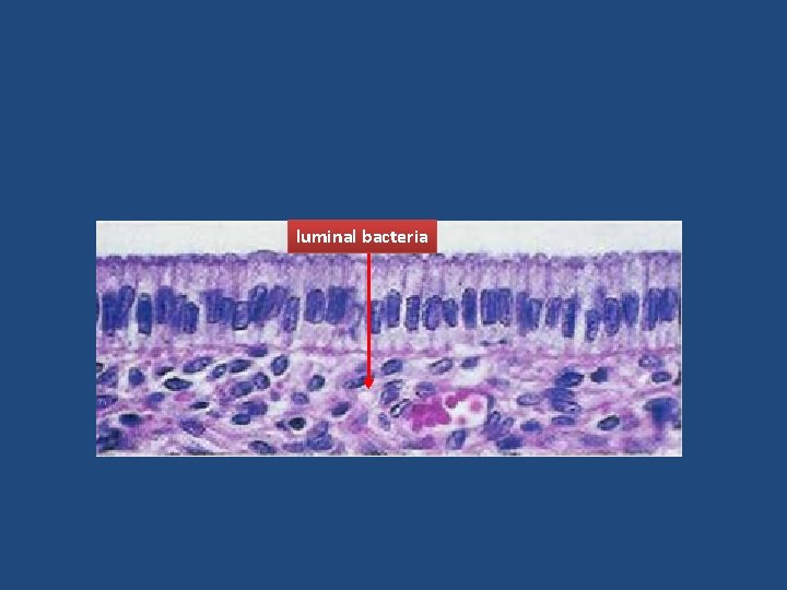 luminal bacteria 