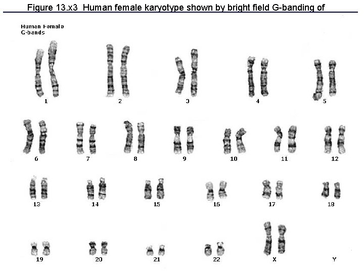 Figure 13. x 3 Human female karyotype shown by bright field G-banding of chromosomes