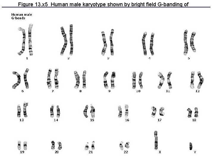 Figure 13. x 5 Human male karyotype shown by bright field G-banding of chromosomes