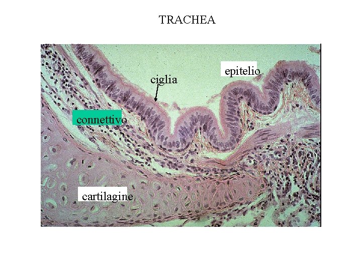 TRACHEA ciglia connettivo cartilagine epitelio 