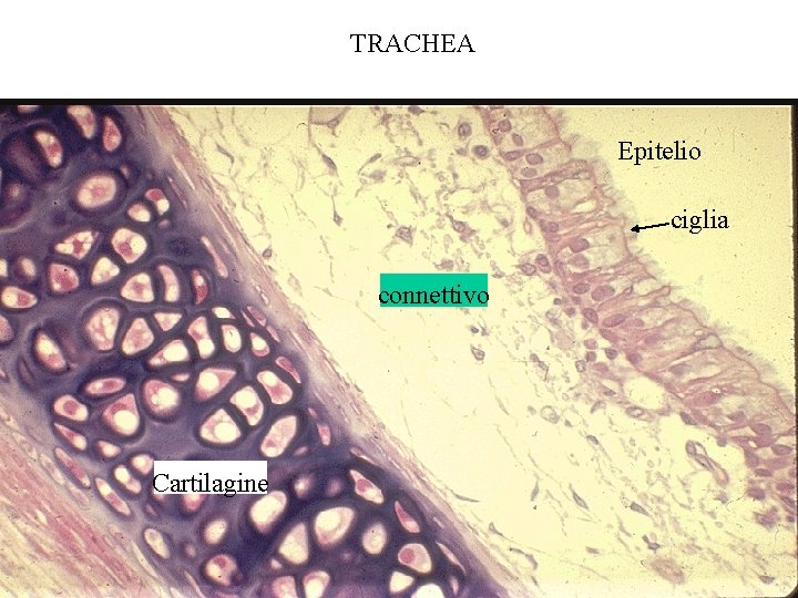 TRACHEA Epitelio ciglia connettivo Cartilagine 