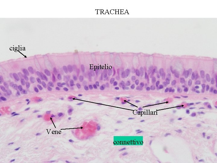 TRACHEA ciglia Epitelio Capillari Vene connettivo 