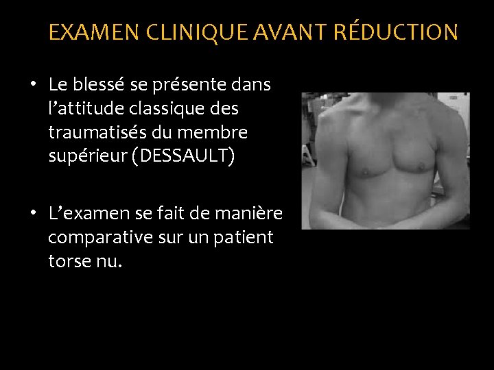 EXAMEN CLINIQUE AVANT RÉDUCTION • Le blessé se présente dans l’attitude classique des traumatisés EXAMEN CLINIQUE AVANT RÉDUCTION • Le blessé se présente dans l’attitude classique des traumatisés