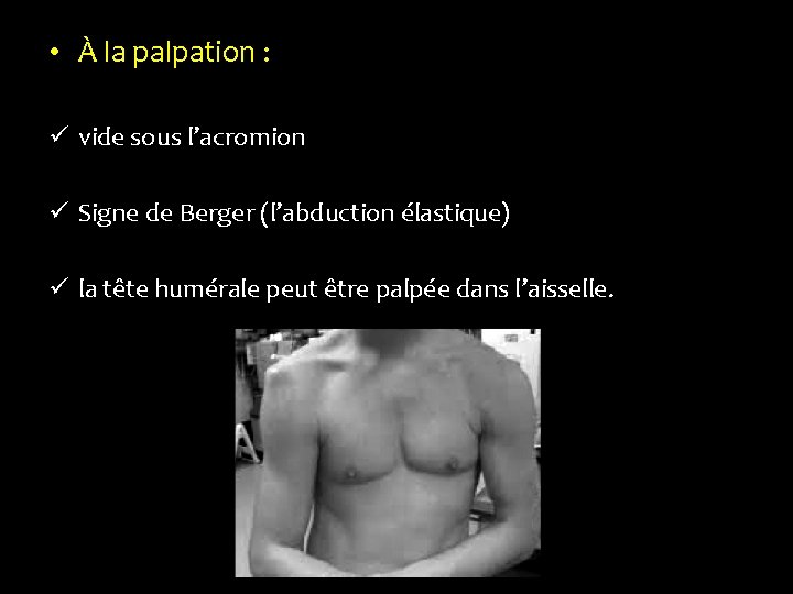  • À la palpation : ü vide sous l’acromion ü Signe de Berger