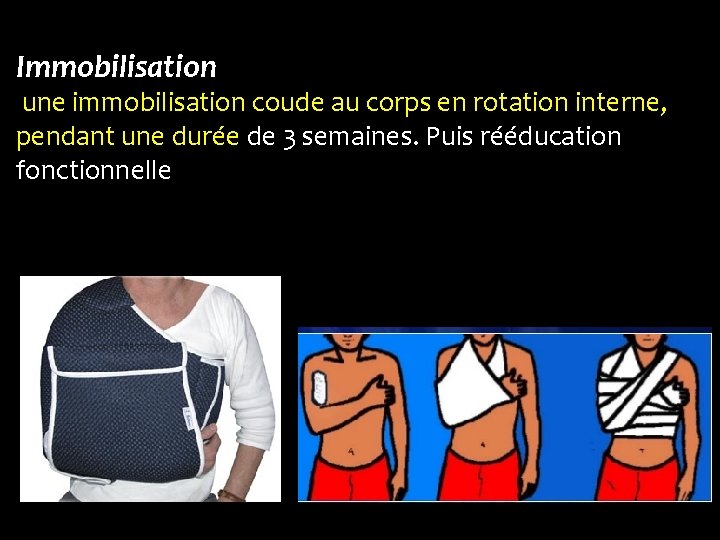 Immobilisation une immobilisation coude au corps en rotation interne, pendant une durée de 3