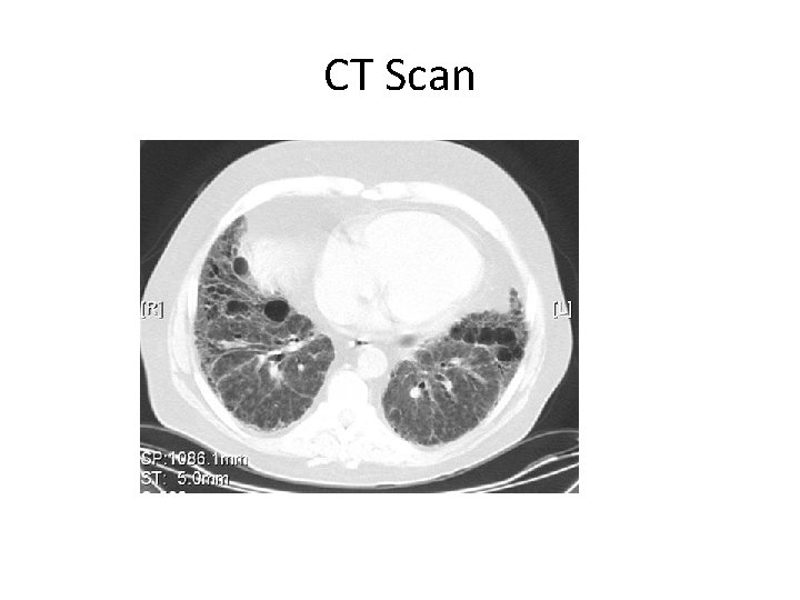 CT Scan 