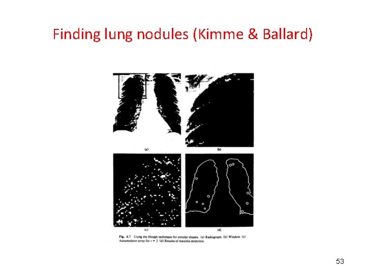 Finding lung nodules (Kimme & Ballard) 53 