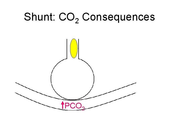 Shunt: CO 2 Consequences PCO 2 