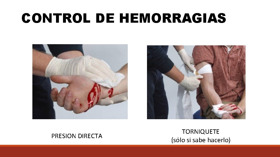 CONTROL DE HEMORRAGIAS PRESION DIRECTA TORNIQUETE (sólo si sabe hacerlo) 