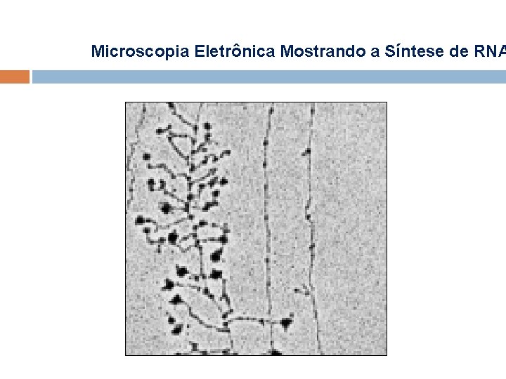Microscopia Eletrônica Mostrando a Síntese de RNA Microscopia Eletrônica Mostrando a Síntese de RNA