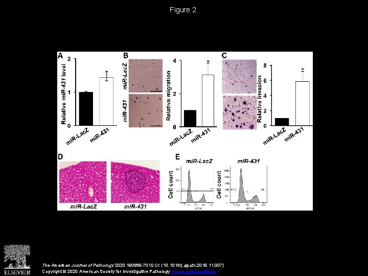 Figure 2 The American Journal of Pathology 2020 190689 -701 DOI: (10. 1016/j. ajpath.