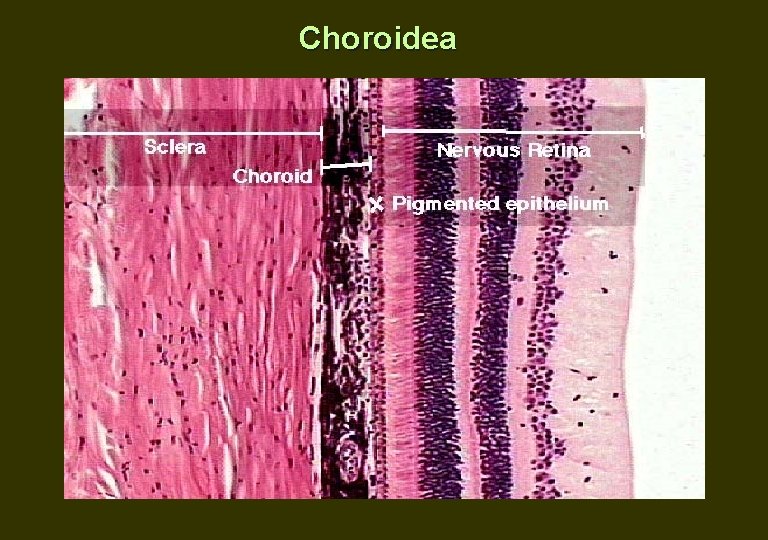 Choroidea 