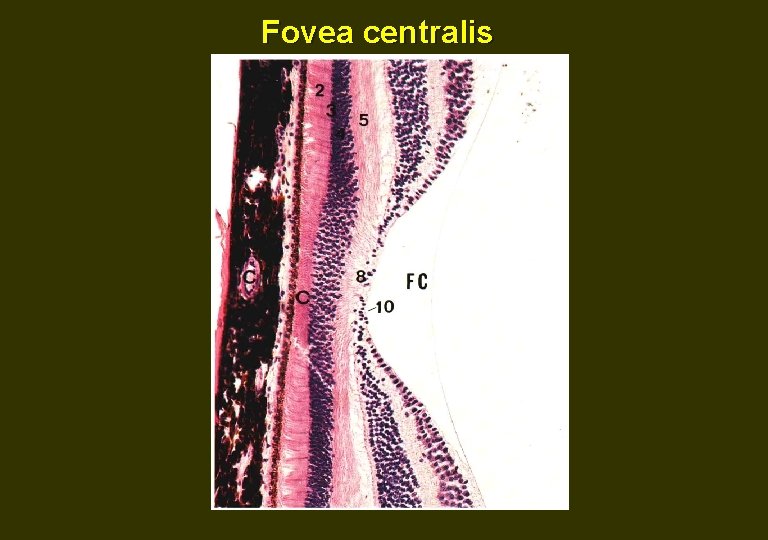 Fovea centralis 