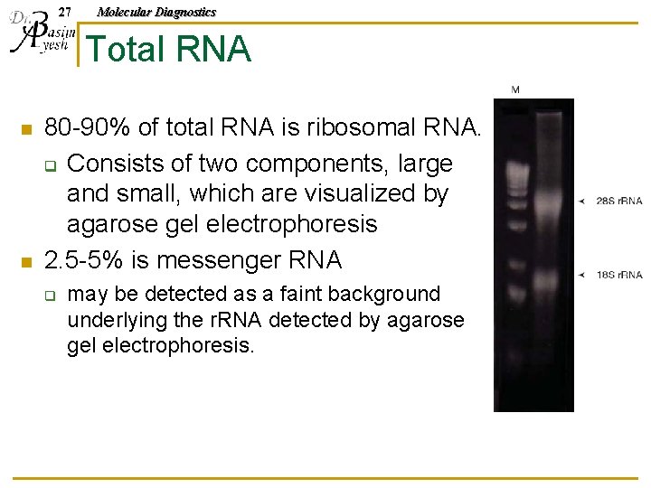 27 Molecular Diagnostics Total RNA n n 80 -90% of total RNA is ribosomal