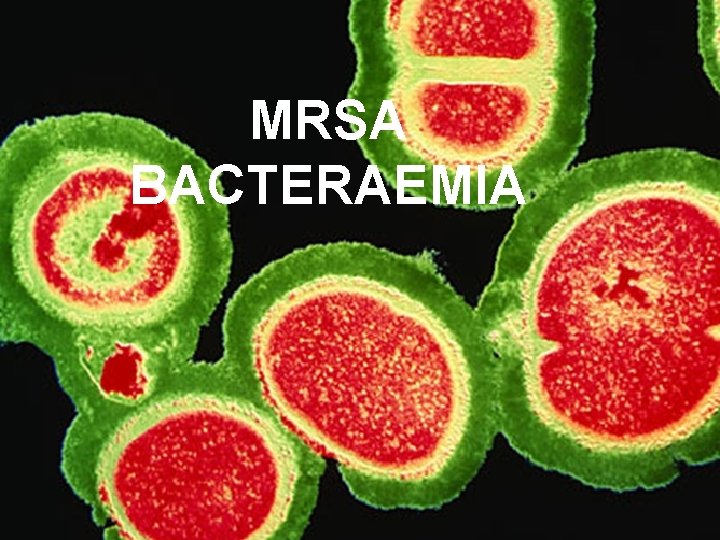 MRSA BACTERAEMIA 