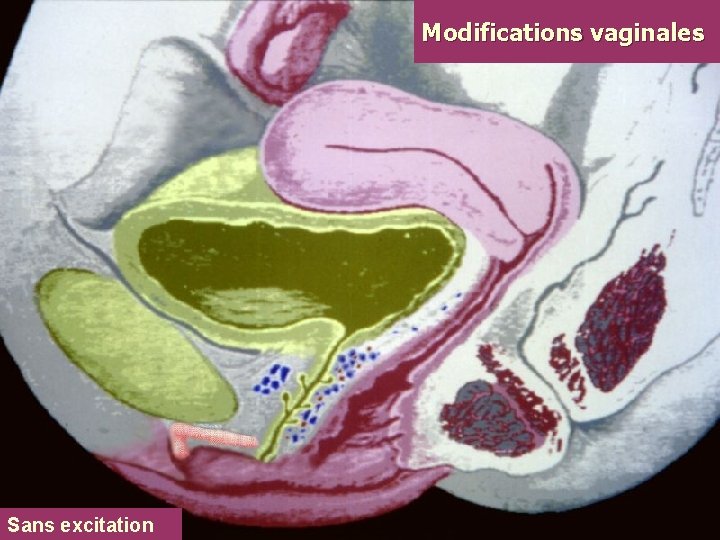 Modifications vaginales Sans excitation 