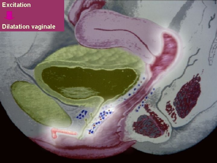 Excitation Dilatation vaginale 