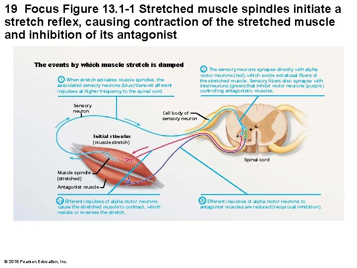 19 Focus Figure 13. 1 -1 Stretched muscle spindles initiate a stretch reflex, causing