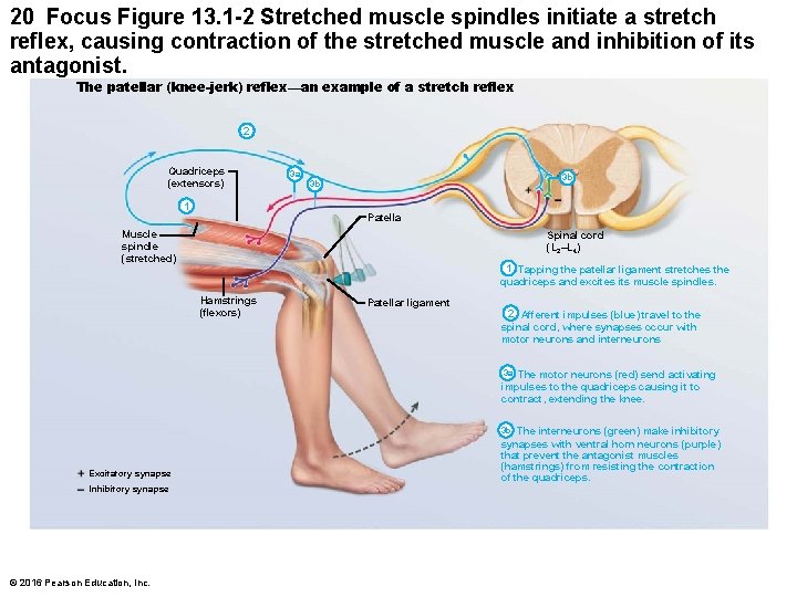 20 Focus Figure 13. 1 -2 Stretched muscle spindles initiate a stretch reflex, causing