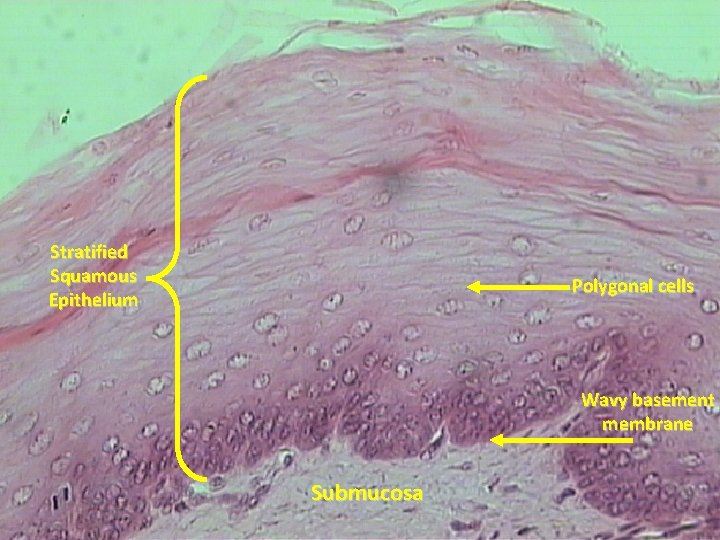 Stratified Squamous Epithelium Polygonal cells Wavy basement membrane Submucosa 