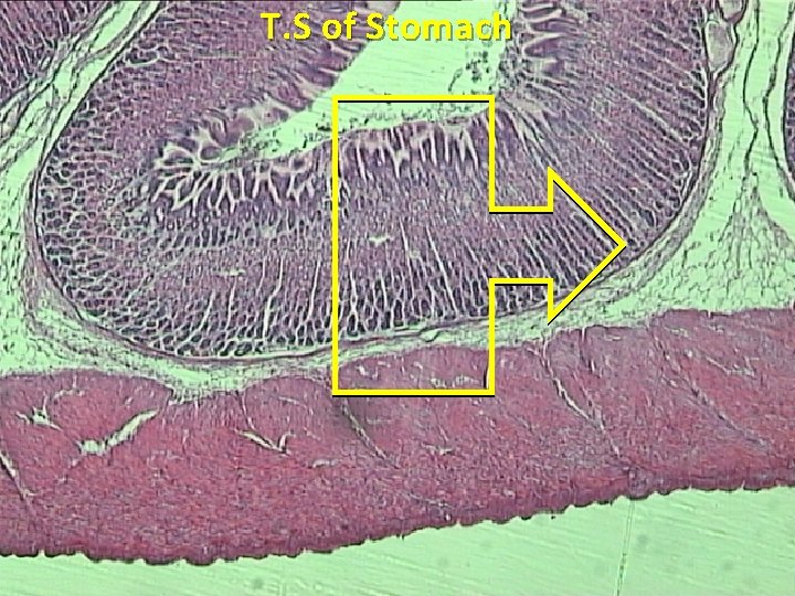T. S of Stomach 