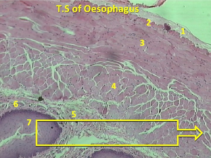 T. S of Oesophagus 2 3 4 6 7 5 1 