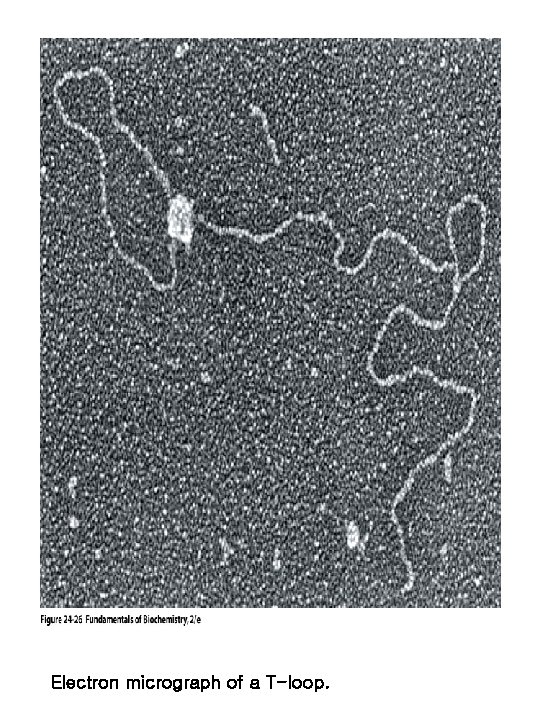 Electron micrograph of a T-loop. 