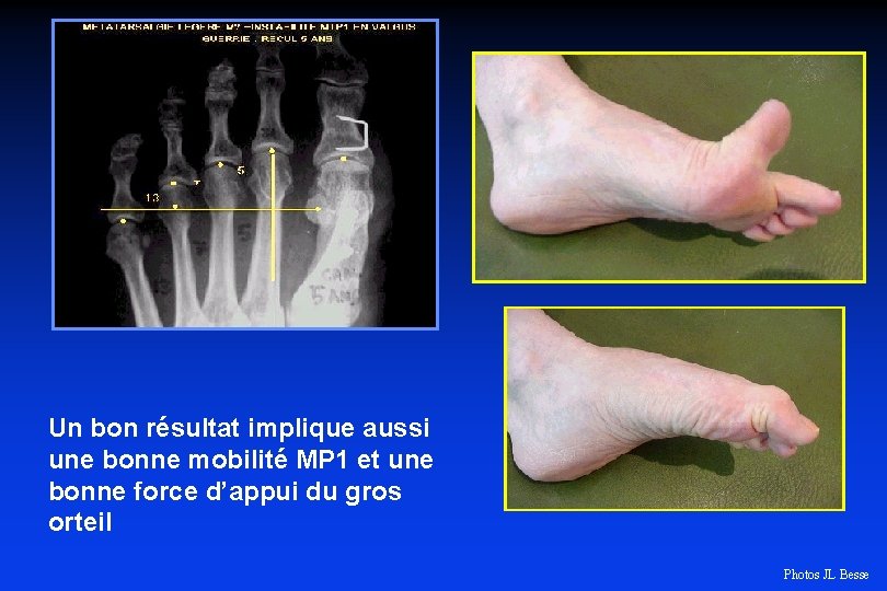 Un bon résultat implique aussi une bonne mobilité MP 1 et une bonne force